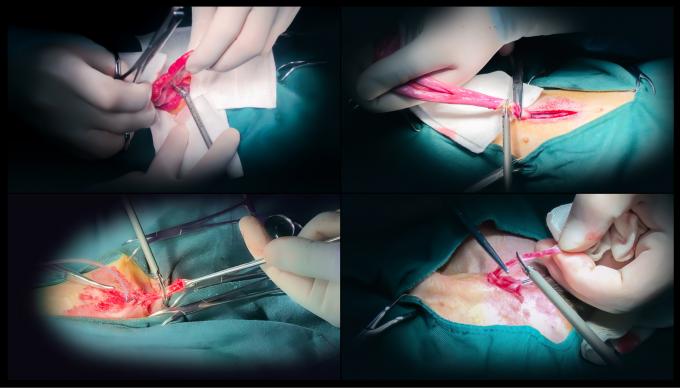 Laparoscope การผ่าตัด Ultrasonic Scalpel System Hemostasis สำหรับใช้ในสัตวแพทย์ 6